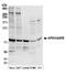 Acylaminoacyl-Peptide Hydrolase antibody, A304-808A, Bethyl Labs, Western Blot image 
