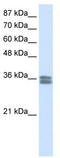 Calcium Voltage-Gated Channel Auxiliary Subunit Gamma 4 antibody, TA331463, Origene, Western Blot image 