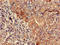 Non-receptor tyrosine-protein kinase TYK2 antibody, LS-C682268, Lifespan Biosciences, Immunohistochemistry paraffin image 