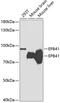 Erythrocyte Membrane Protein Band 4.1 antibody, 18-664, ProSci, Western Blot image 