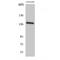 Alpha Kinase 1 antibody, LS-C386761, Lifespan Biosciences, Western Blot image 