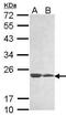 Membrane Anchored Junction Protein antibody, PA5-34721, Invitrogen Antibodies, Western Blot image 