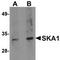 Spindle And Kinetochore Associated Complex Subunit 1 antibody, TA306843, Origene, Western Blot image 