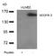Fms Related Tyrosine Kinase 4 antibody, AP26050PU-N, Origene, Western Blot image 