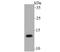 Presenilin Enhancer, Gamma-Secretase Subunit antibody, A04504-1, Boster Biological Technology, Western Blot image 