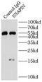 SNAP Associated Protein antibody, FNab08060, FineTest, Immunoprecipitation image 
