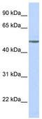 Adrenoceptor Beta 1 antibody, TA341637, Origene, Western Blot image 