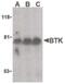 Bruton Tyrosine Kinase antibody, PA5-20085, Invitrogen Antibodies, Western Blot image 