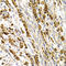 NK-3R antibody, LS-C349051, Lifespan Biosciences, Immunohistochemistry paraffin image 