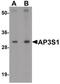 AP-3 complex subunit sigma-1 antibody, PA5-21161, Invitrogen Antibodies, Western Blot image 