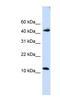 DNA dC->dU-editing enzyme APOBEC-3F antibody, NBP1-57515, Novus Biologicals, Western Blot image 