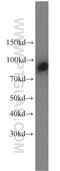 Complement C1s subcomponent antibody, 14554-1-AP, Proteintech Group, Western Blot image 