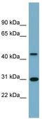 Armadillo Repeat Containing X-Linked 3 antibody, TA342021, Origene, Western Blot image 