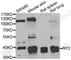 RP2 Activator Of ARL3 GTPase antibody, A6972, ABclonal Technology, Western Blot image 