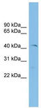 ETV7 antibody, TA331927, Origene, Western Blot image 