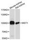 Hepatocyte growth factor-like protein antibody, A01069, Boster Biological Technology, Western Blot image 