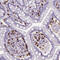 CD8 antibody, HPA037756, Atlas Antibodies, Immunohistochemistry paraffin image 