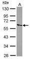 Zinc Finger And SCAN Domain Containing 26 antibody, NBP2-20970, Novus Biologicals, Western Blot image 