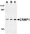 Dihydropyrimidinase-related protein 1 antibody, NBP1-76651, Novus Biologicals, Western Blot image 