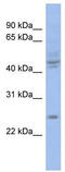 PROP Paired-Like Homeobox 1 antibody, TA343595, Origene, Western Blot image 