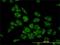Histidyl-TRNA Synthetase antibody, H00003035-M01, Novus Biologicals, Immunocytochemistry image 