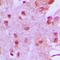 Menin 1 antibody, LS-C352504, Lifespan Biosciences, Immunohistochemistry paraffin image 