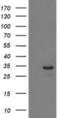 Haloacid Dehalogenase Like Hydrolase Domain Containing 2 antibody, NBP2-00697, Novus Biologicals, Western Blot image 