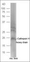 CTP Synthase 2 antibody, orb182795, Biorbyt, Western Blot image 