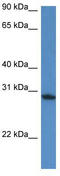 Family With Sequence Similarity 168 Member A antibody, TA333420, Origene, Western Blot image 