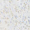 Cysteine Rich Hydrophobic Domain 2 antibody, 23-319, ProSci, Immunohistochemistry paraffin image 