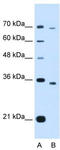 PHD Finger Protein 6 antibody, TA339154, Origene, Western Blot image 