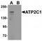 Calcium-transporting ATPase type 2C member 1 antibody, TA319887, Origene, Western Blot image 