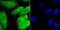 GATA Binding Protein 4 antibody, A00499-2, Boster Biological Technology, Immunocytochemistry image 