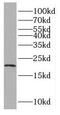 Rac Family Small GTPase 2 antibody, FNab07068, FineTest, Western Blot image 