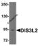 DIS3 Like 3'-5' Exoribonuclease 2 antibody, 8347, ProSci, Western Blot image 