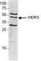 WD Repeat Domain 5 antibody, TA347313, Origene, Western Blot image 
