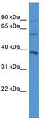 Neuropilin And Tolloid Like 1 antibody, TA342747, Origene, Western Blot image 