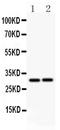Fas Ligand antibody, LS-C312734, Lifespan Biosciences, Western Blot image 