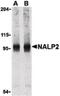 NBS1 antibody, LS-B529, Lifespan Biosciences, Western Blot image 