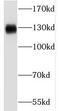 RNA Binding Motif Protein 6 antibody, FNab07183, FineTest, Western Blot image 