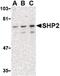 Protein Tyrosine Phosphatase Non-Receptor Type 11 antibody, PA5-20278, Invitrogen Antibodies, Western Blot image 