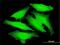 Poly(A) Polymerase Beta antibody, H00056903-M01, Novus Biologicals, Immunofluorescence image 