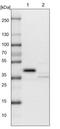Poly(RC) Binding Protein 3 antibody, NBP1-89505, Novus Biologicals, Western Blot image 