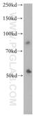 Cytochrome P450 Family 2 Subfamily S Member 1 antibody, 13654-1-AP, Proteintech Group, Western Blot image 