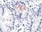 Helicobacter pylori antibody, PA5-32442, Invitrogen Antibodies, Immunohistochemistry frozen image 