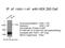 Neuropathy target esterase antibody, 14261-1-AP, Proteintech Group, Immunoprecipitation image 