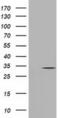 Uridine-cytidine kinase 1 antibody, MA5-25203, Invitrogen Antibodies, Western Blot image 