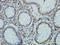 General Transcription Factor IIIC Subunit 2 antibody, LS-C133227, Lifespan Biosciences, Immunohistochemistry paraffin image 