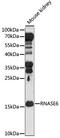 Ribonuclease A Family Member K6 antibody, A15312, ABclonal Technology, Western Blot image 