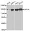 Carnitine Palmitoyltransferase 1A antibody, PA5-76788, Invitrogen Antibodies, Western Blot image 